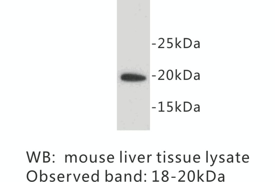 Western Blot - Anti-SCA1 Antibody (BPA1093) - Antibodies.com