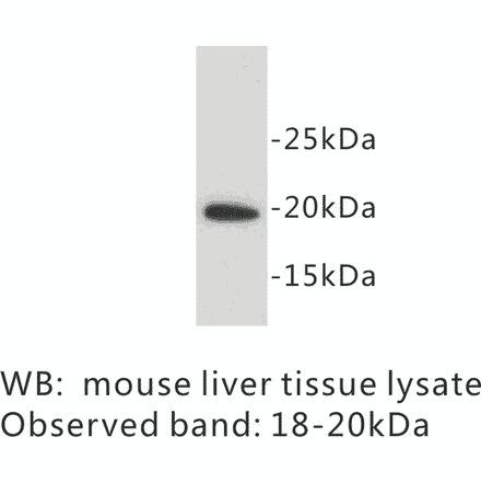 Western Blot - Anti-SCA1 Antibody (BPA1093) - Antibodies.com