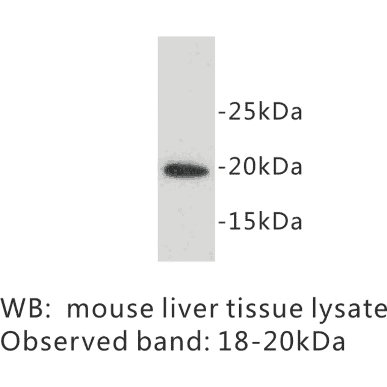Western Blot - Anti-SCA1 Antibody (BPA1093) - Antibodies.com