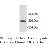 Western Blot - Anti-SCA1 Antibody (BPA1093) - Antibodies.com