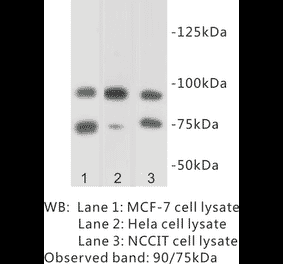 Western Blot - Anti-SUZ12 Antibody (BPA1095) - Antibodies.com