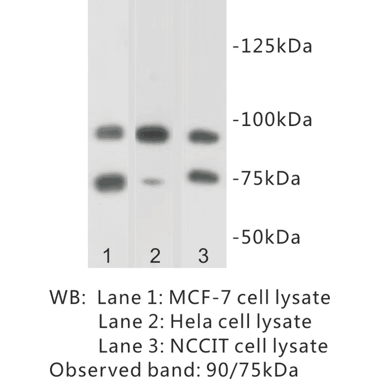 Western Blot - Anti-SUZ12 Antibody (BPA1095) - Antibodies.com