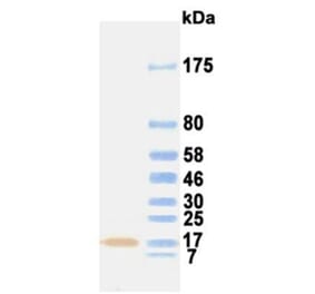Western Blot - Anti-FGF1 (aFGF) Antibody (031116C06) - Antibodies.com