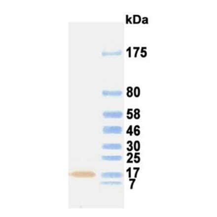 Western Blot - Anti-FGF1 (aFGF) Antibody (031116C06) - Antibodies.com