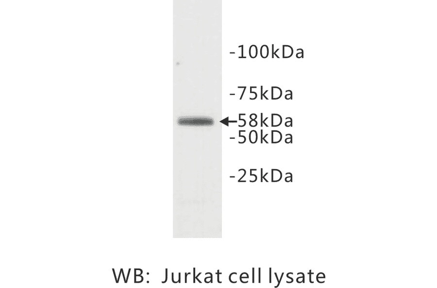 Western Blot - Anti-TDT Antibody (BPA1097) - Antibodies.com