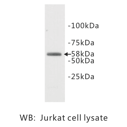 Western Blot - Anti-TDT Antibody (BPA1097) - Antibodies.com