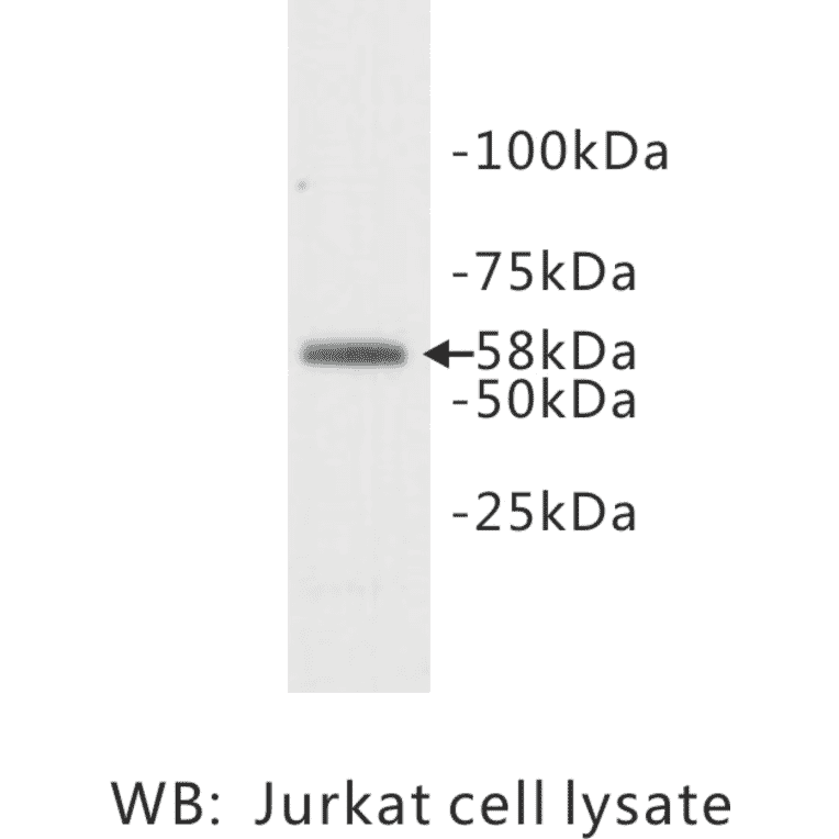 Western Blot - Anti-TDT Antibody (BPA1097) - Antibodies.com