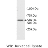 Western Blot - Anti-TDT Antibody (BPA1097) - Antibodies.com