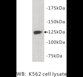 Western Blot - Anti-TIE1 Antibody (BPA1099) - Antibodies.com