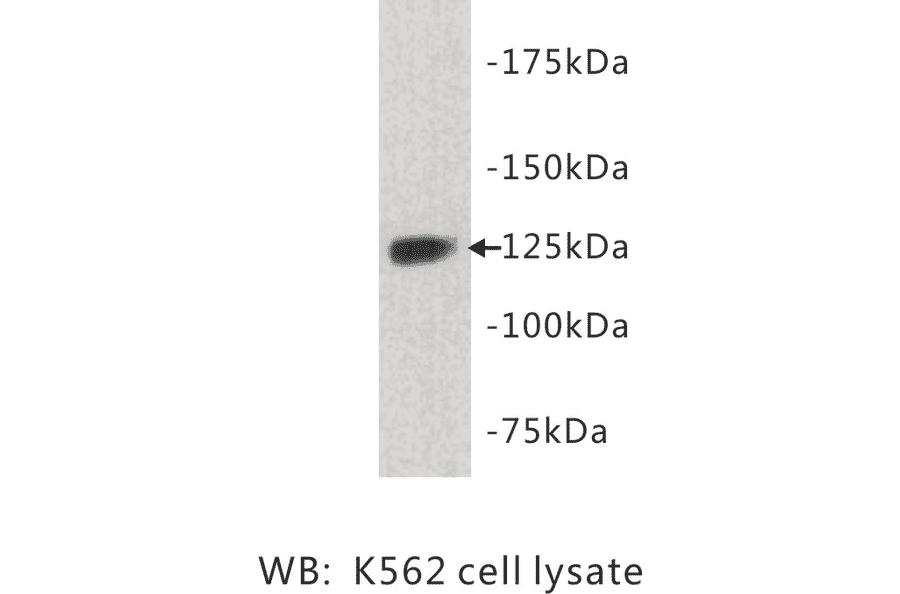 Western Blot - Anti-TIE1 Antibody (BPA1099) - Antibodies.com