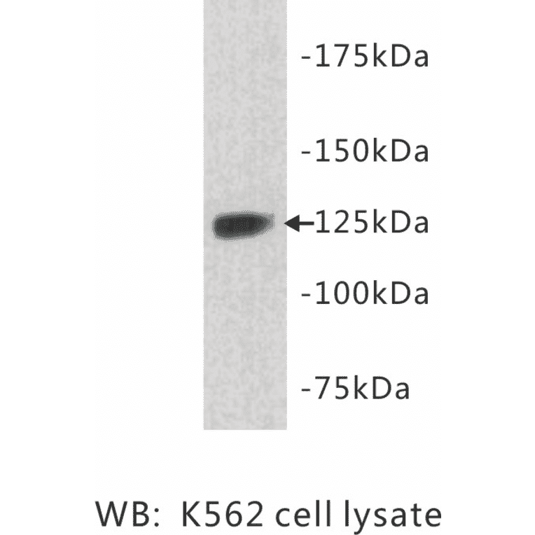 Western Blot - Anti-TIE1 Antibody (BPA1099) - Antibodies.com