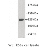 Western Blot - Anti-TIE1 Antibody (BPA1099) - Antibodies.com