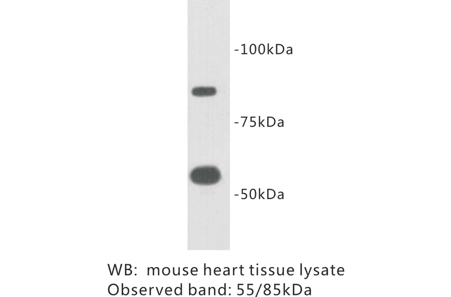 Western Blot - Anti-TTMEM2 Antibody (BPA1101) - Antibodies.com
