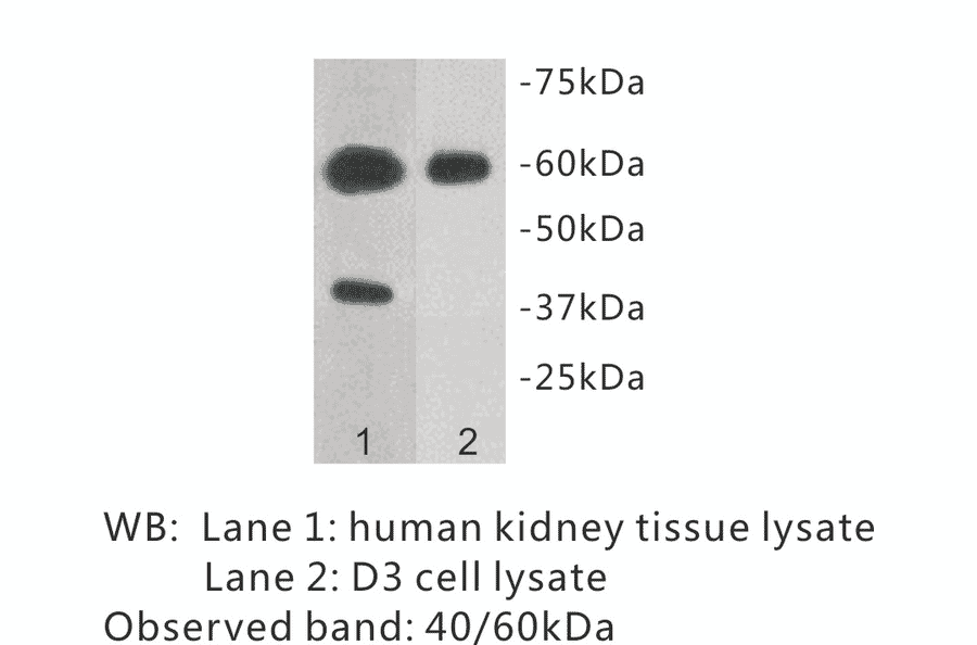 Western Blot - Anti-TMEM57 Antibody (BPA1102) - Antibodies.com