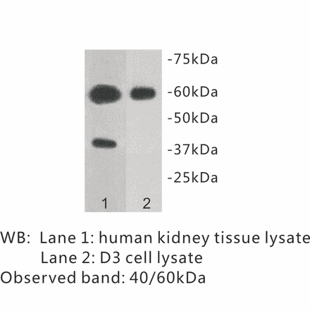 Western Blot - Anti-TMEM57 Antibody (BPA1102) - Antibodies.com