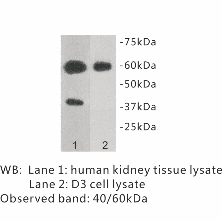 Western Blot - Anti-TMEM57 Antibody (BPA1102) - Antibodies.com