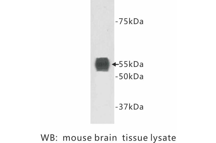 Western Blot - Anti-TMEM132A Antibody (BPA1103) - Antibodies.com