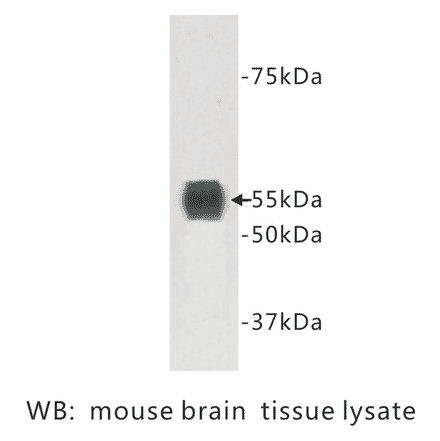 Western Blot - Anti-TMEM132A Antibody (BPA1103) - Antibodies.com