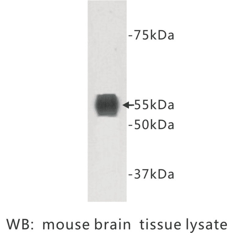 Western Blot - Anti-TMEM132A Antibody (BPA1103) - Antibodies.com
