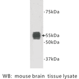 Western Blot - Anti-TMEM132A Antibody (BPA1103) - Antibodies.com