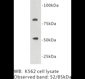 Western Blot - Anti-Protein C Antibody (BPA1109) - Antibodies.com