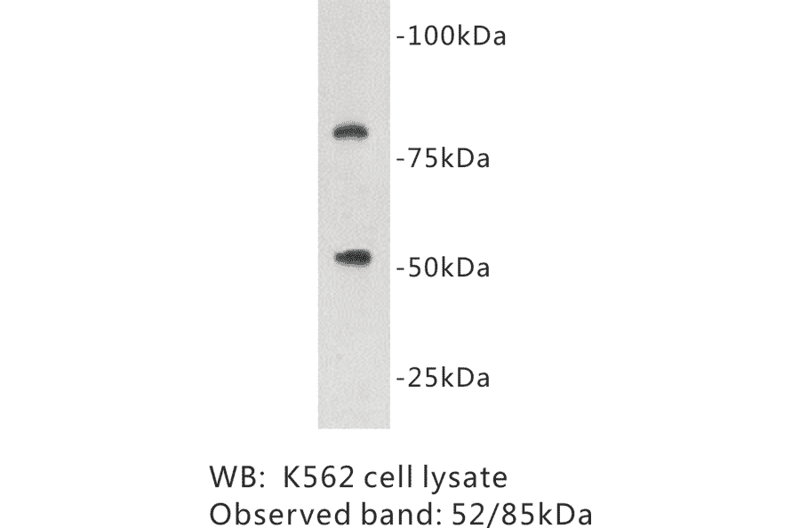 Western Blot - Anti-Protein C Antibody (BPA1109) - Antibodies.com