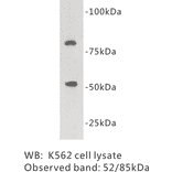 Western Blot - Anti-Protein C Antibody (BPA1109) - Antibodies.com