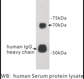 Western Blot - Anti-Protein S Antibody (BPA1110) - Antibodies.com