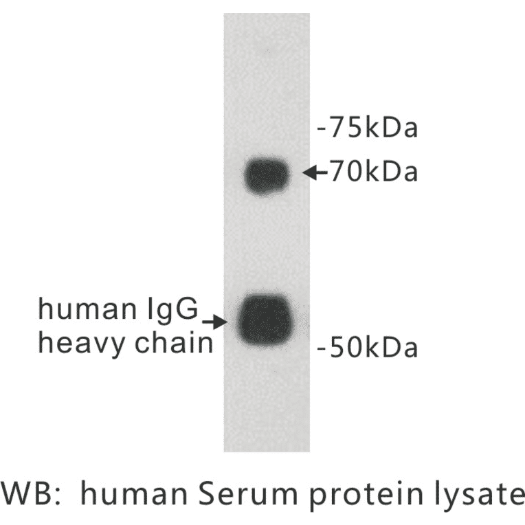 Western Blot - Anti-Protein S Antibody (BPA1110) - Antibodies.com