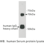 Western Blot - Anti-Protein S Antibody (BPA1110) - Antibodies.com