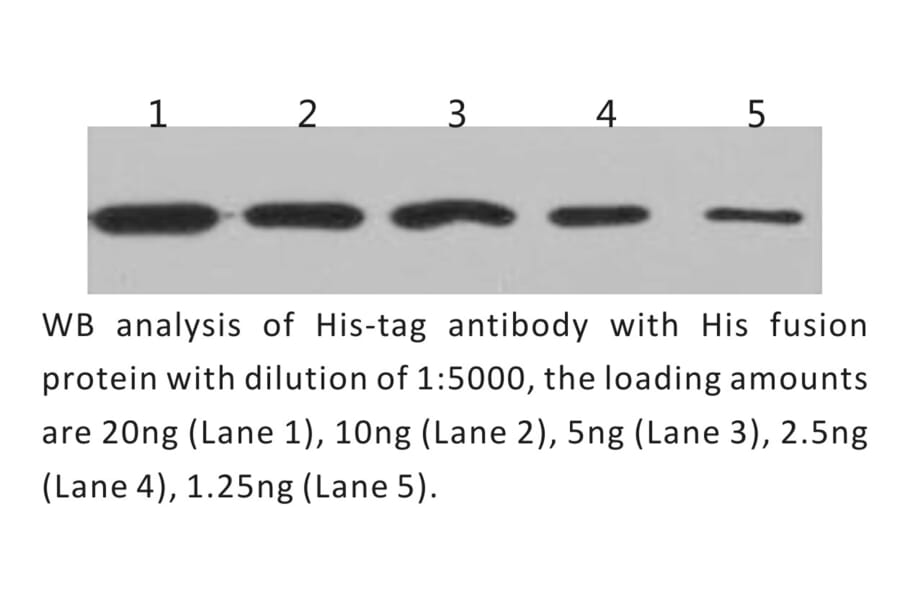Western Blot - Anti-His Tag Antibody (BTL1010) - Antibodies.com