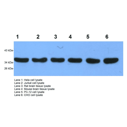 Western Blot - Anti-GAPDH Antibody (BTL1030) - Antibodies.com