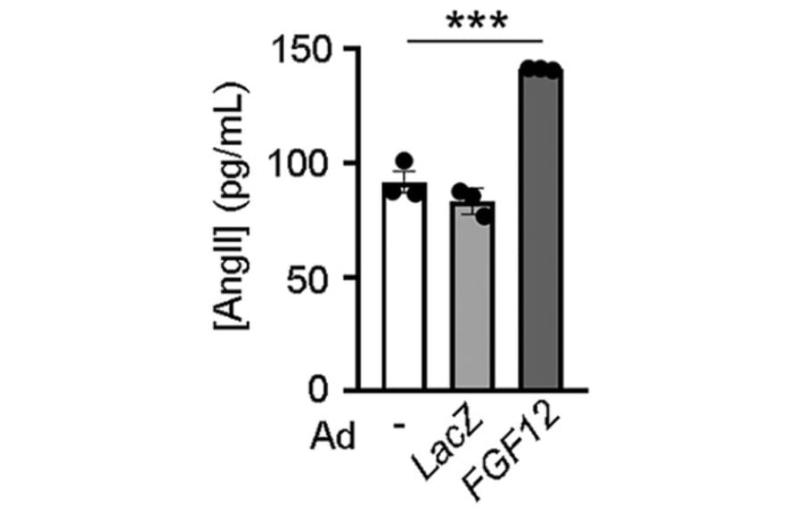 ELISA - Human Angiotensin II ELISA Kit (A1645) - Antibodies.com