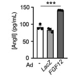 ELISA - Human Angiotensin II ELISA Kit (A1645) - Antibodies.com