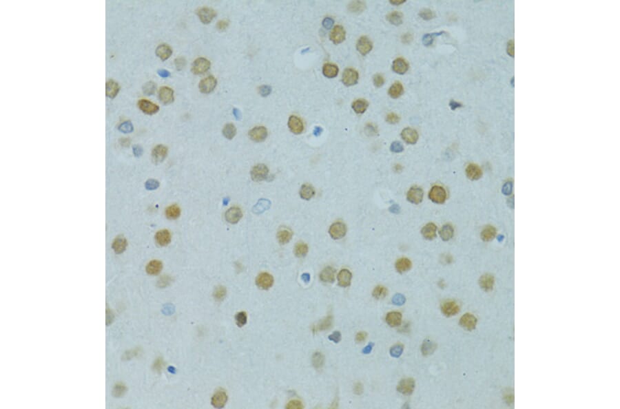 Immunohistochemistry - Anti-Mus81 Antibody (A10001) - Antibodies.com