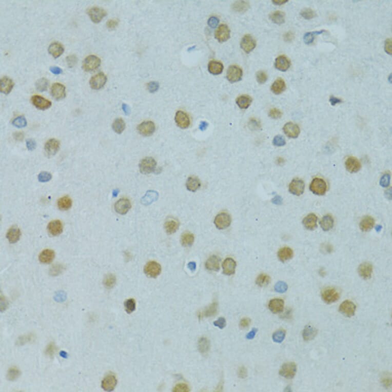 Immunohistochemistry - Anti-Mus81 Antibody (A10001) - Antibodies.com