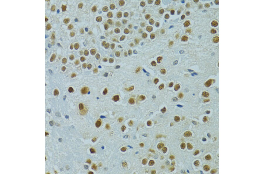 Immunohistochemistry - Anti-Mus81 Antibody (A10001) - Antibodies.com
