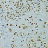 Immunohistochemistry - Anti-Mus81 Antibody (A10001) - Antibodies.com