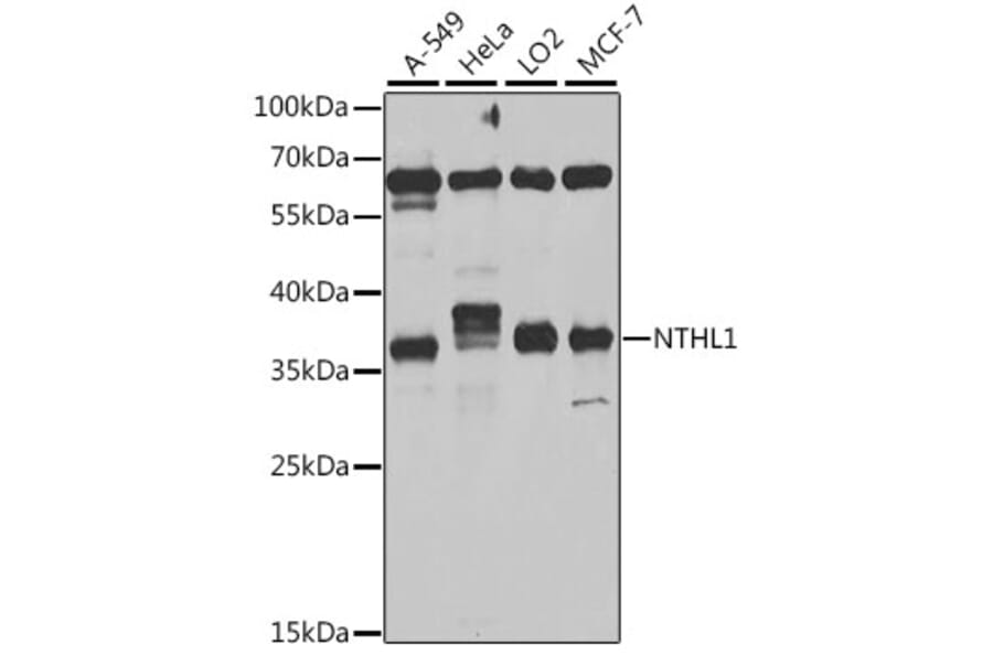 Western Blot - Anti-NTH1 Antibody (A10002) - Antibodies.com