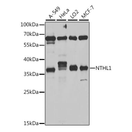 Western Blot - Anti-NTH1 Antibody (A10002) - Antibodies.com