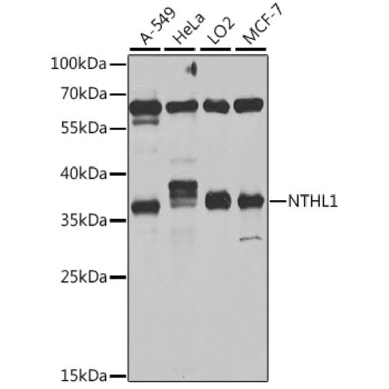 Western Blot - Anti-NTH1 Antibody (A10002) - Antibodies.com