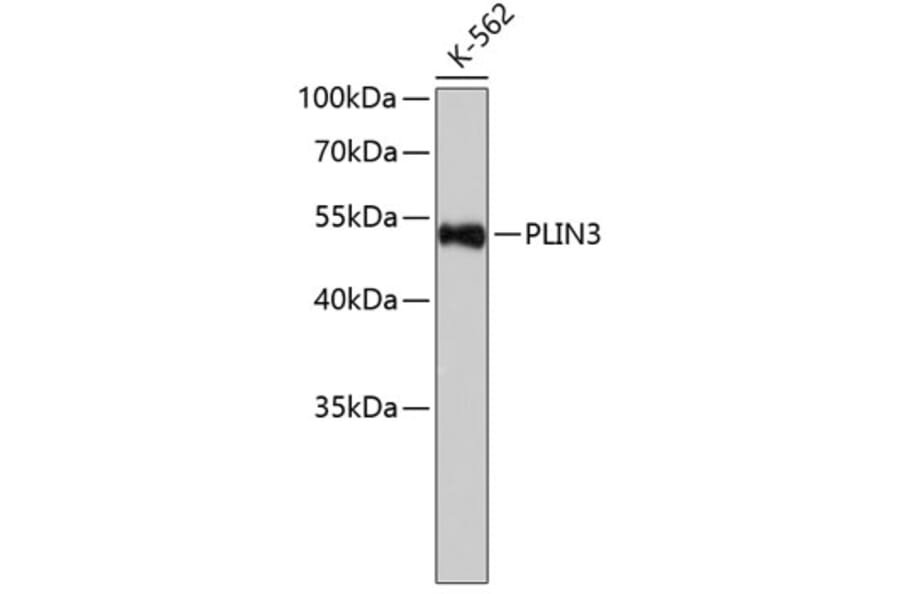 Western Blot - Anti-PLIN3 Antibody (A6822) - Antibodies.com
