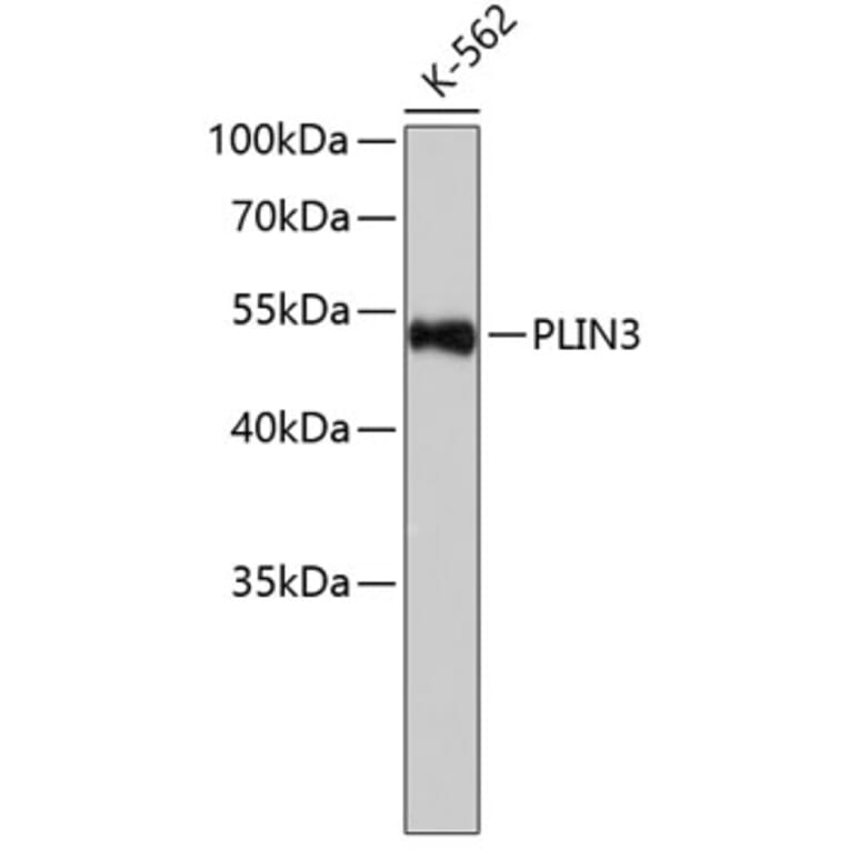 Western Blot - Anti-PLIN3 Antibody (A6822) - Antibodies.com