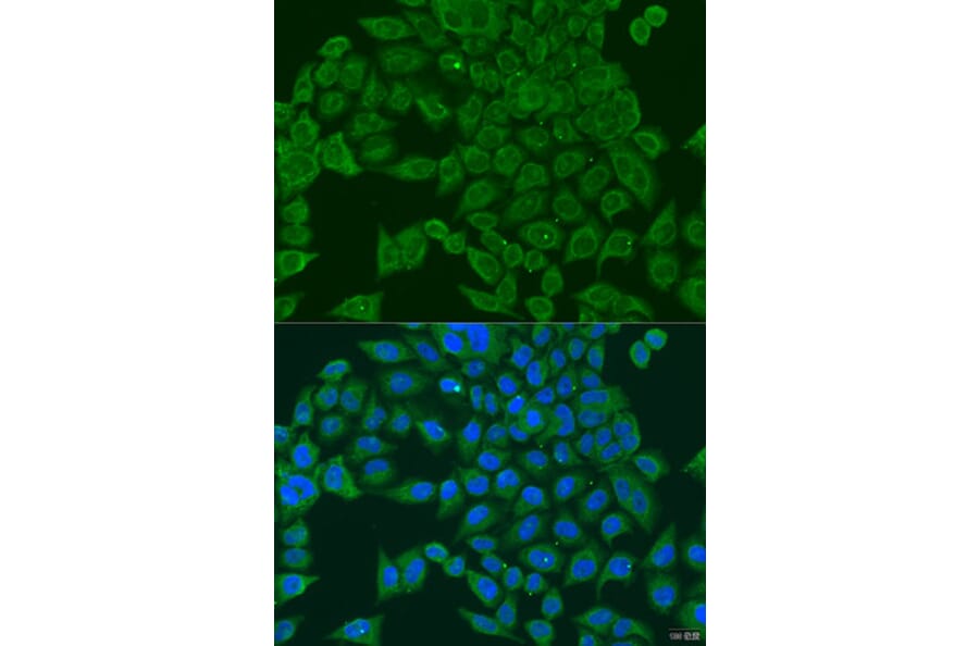 Immunofluorescence - Anti-PIWIL1 Antibody (A6823) - Antibodies.com
