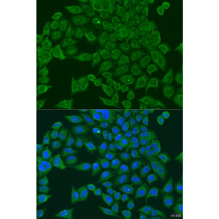 Immunofluorescence - Anti-PIWIL1 Antibody (A6823) - Antibodies.com