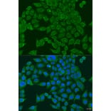 Immunofluorescence - Anti-PIWIL1 Antibody (A6823) - Antibodies.com