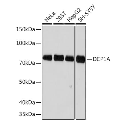 Western Blot - Anti-Dcp1a Antibody [ARC1421] (A10006) - Antibodies.com