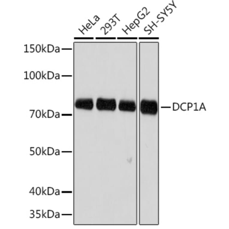 Western Blot - Anti-Dcp1a Antibody [ARC1421] (A10006) - Antibodies.com