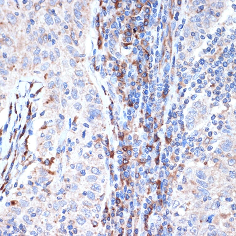 Immunohistochemistry - Anti-Dcp1a Antibody [ARC1421] (A10006) - Antibodies.com