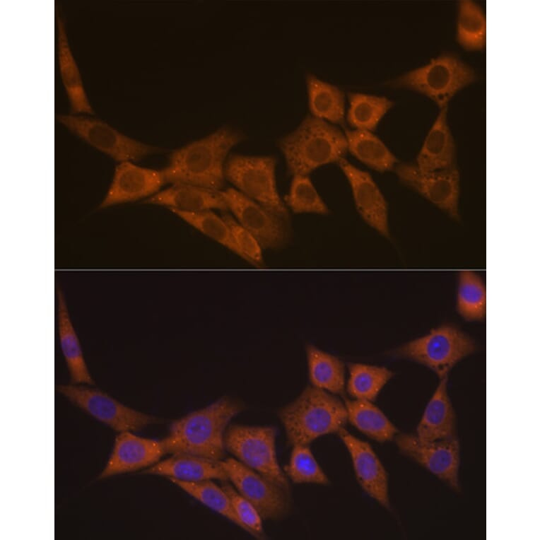 Immunofluorescence - Anti-Dcp1a Antibody [ARC1421] (A10006) - Antibodies.com